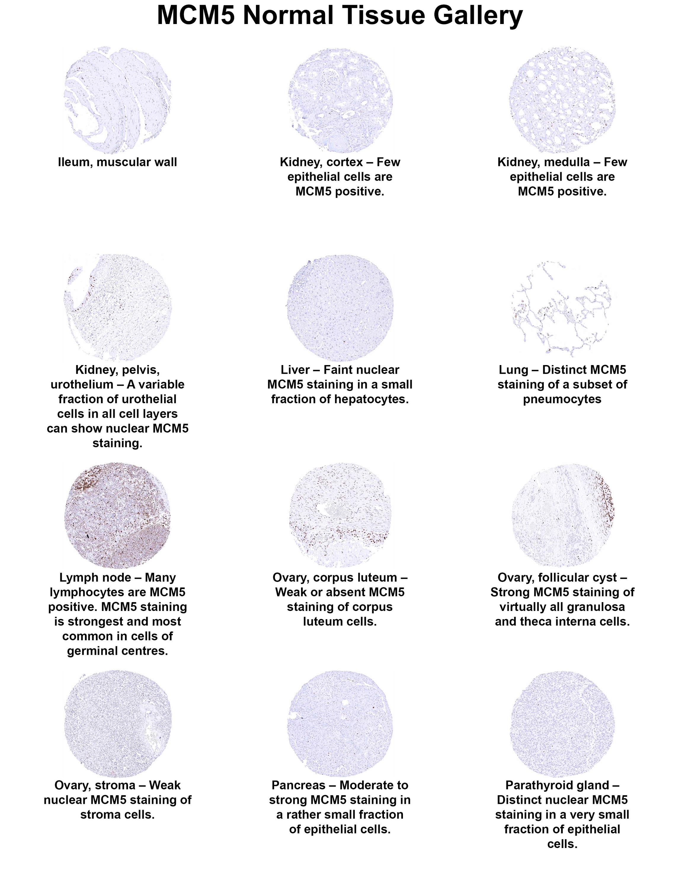 MCM5 Antibody (MSVA-505R) - Azide and BSA Free MCM5 Antibody (MSVA-505R) - Azide and BSA Free MCM5 Normal Tissue Gallery