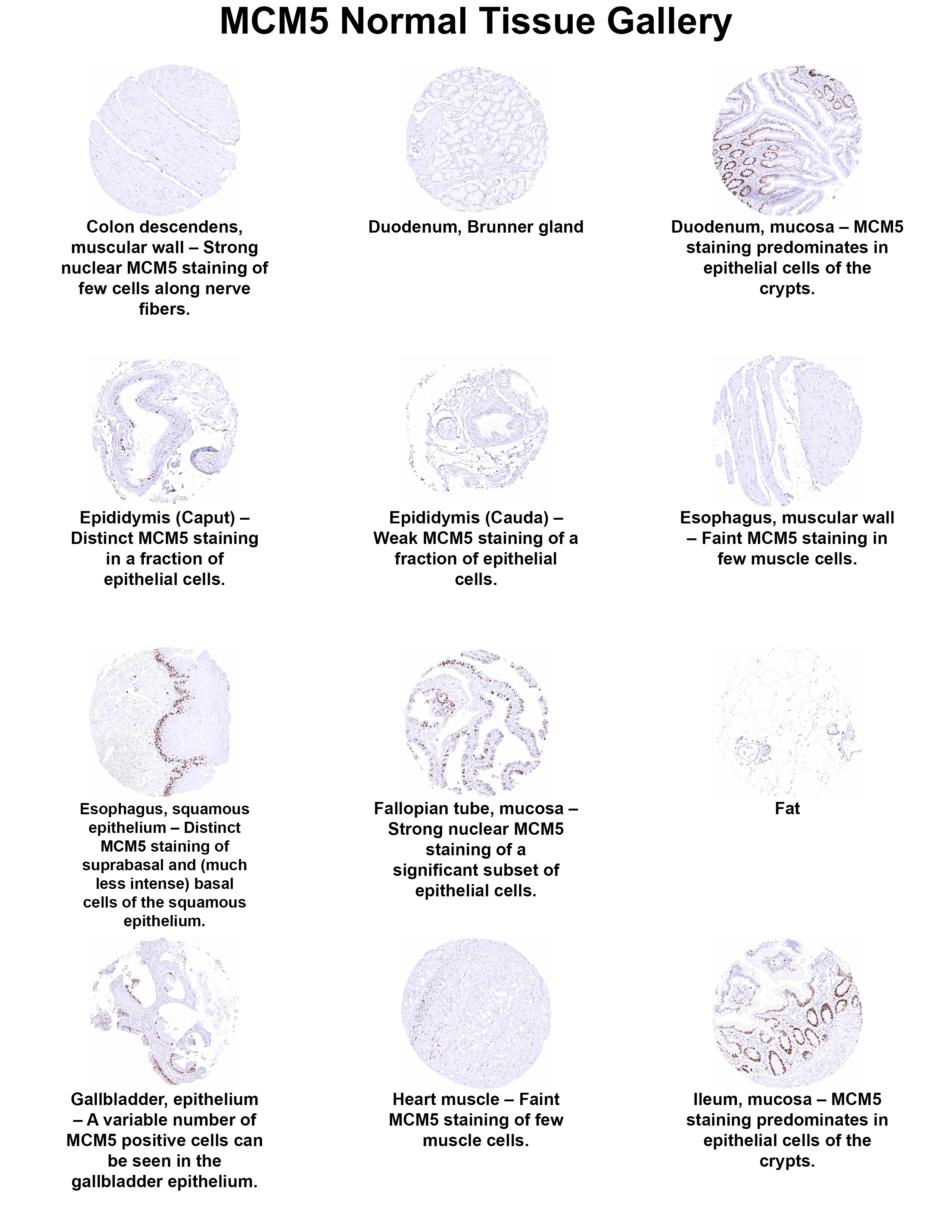 MCM5 Antibody (MSVA-505R) - Azide and BSA Free MCM5 Antibody (MSVA-505R) - Azide and BSA Free MCM5 Normal Tissue Gallery