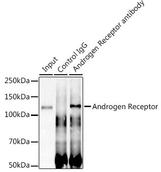 Androgen R/NR3C4 Antibody (10G4D3) Immunoprecipitation: Androgen R/NR3C4 Antibody (10G4D3) [NBP3-57373]