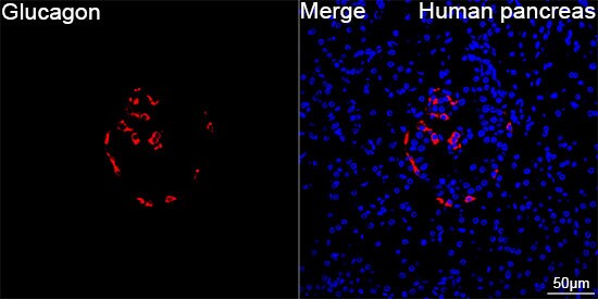 Glucagon Antibody (10F6I3) Immunohistochemistry-Paraffin: Glucagon Antibody (10F6I3) [NBP3-57382]