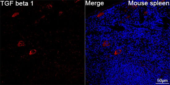 TGF-beta 1 Antibody (10X3C4) Immunohistochemistry-Paraffin: TGF-beta 1 Antibody (10X3C4) [NBP3-57388]