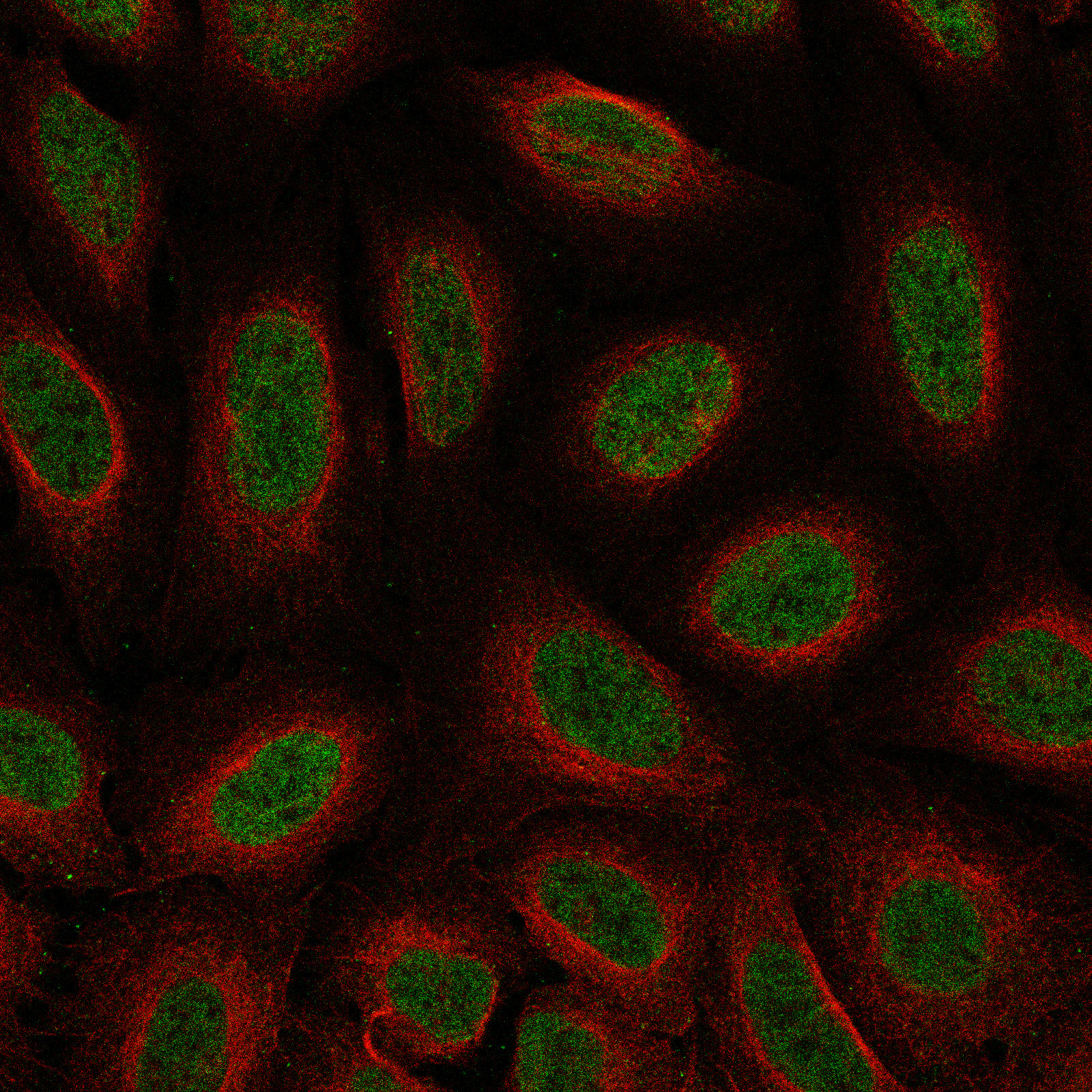 SATB2 Antibody (CL0323) - BSA Free