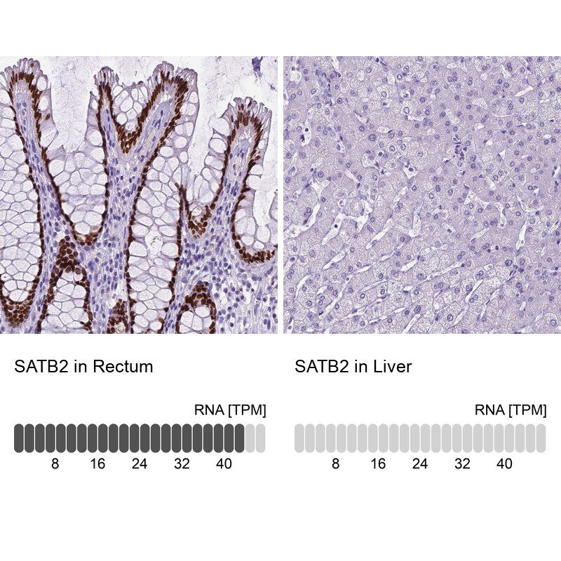 SATB2 Antibody (CL0323) - BSA Free