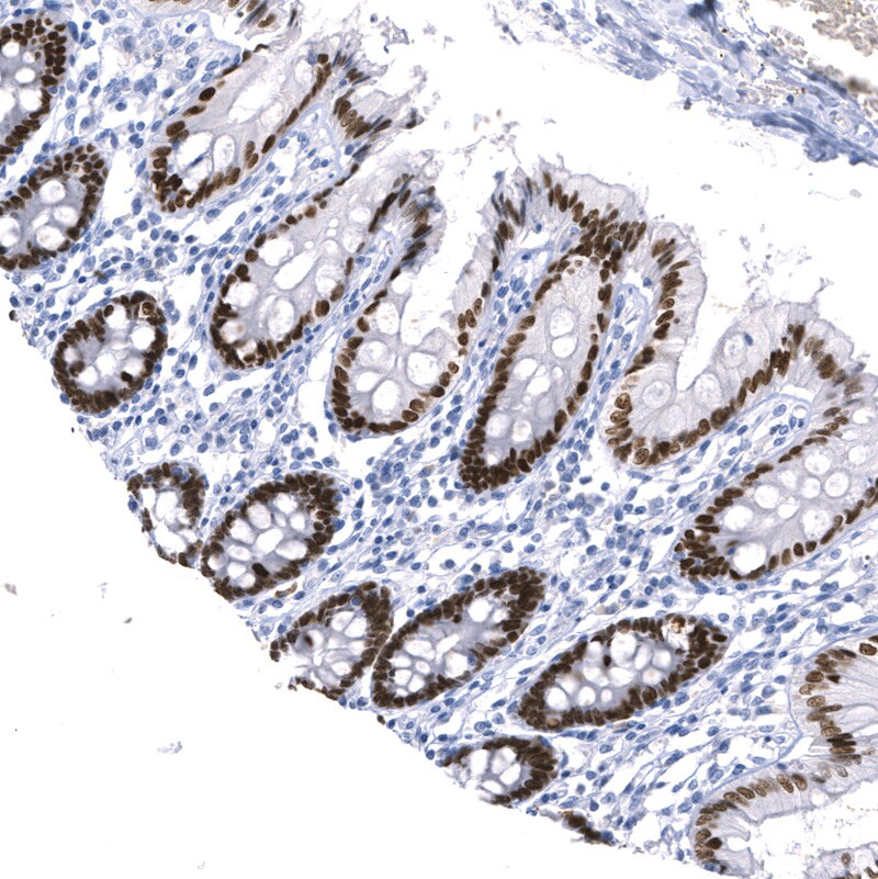 SATB2 Antibody (CL0323) - BSA Free