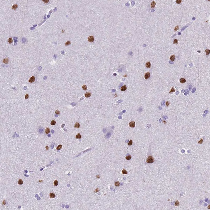 SATB2 Antibody (CL0323) - BSA Free