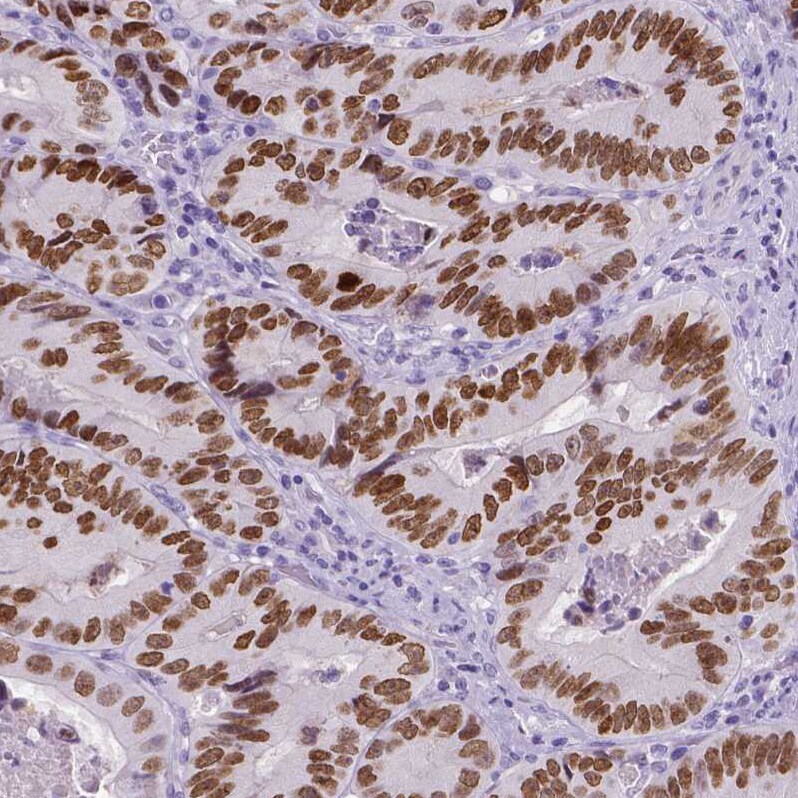 SATB2 Antibody (CL0323) - BSA Free