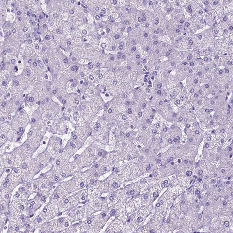 SATB2 Antibody (CL0323) - BSA Free