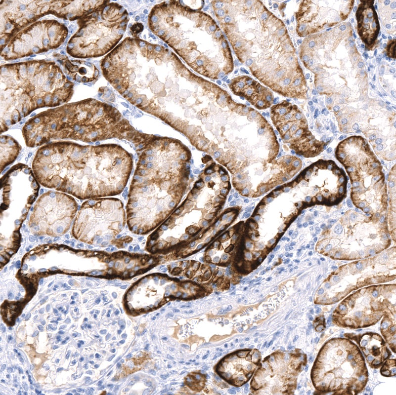Carbonic Anhydrase XII/CA12 Antibody (CL0280) - BSA Free