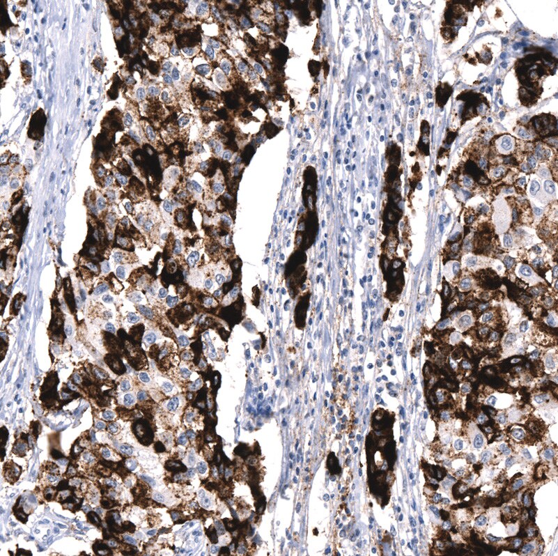 MUC5AC Antibody (CL8961) - BSA Free