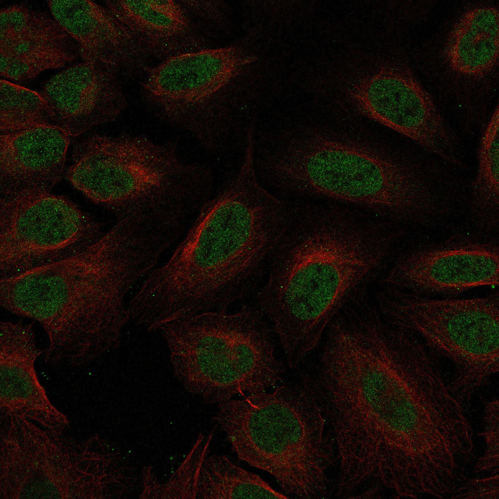 NRSF Antibody (CL0381) - BSA Free