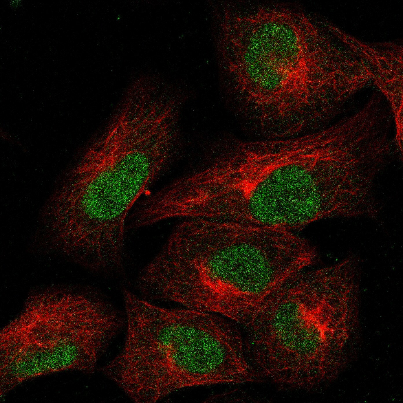 TCF-2/HNF-1 beta Antibody (CL0374) - BSA Free