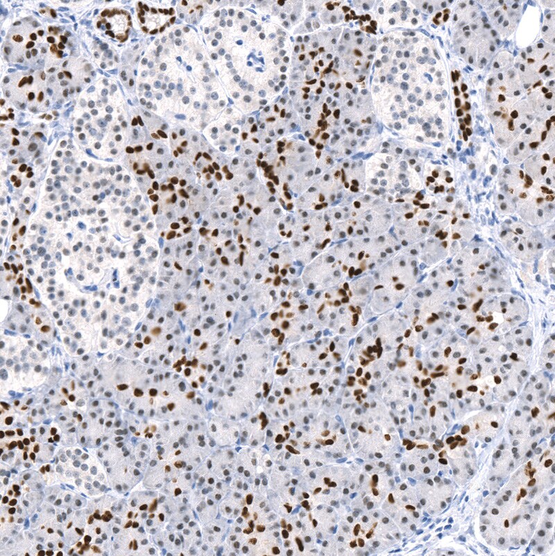 TCF-2/HNF-1 beta Antibody (CL0374) - BSA Free
