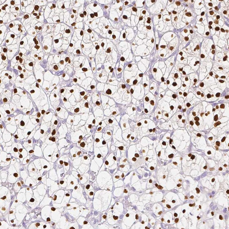 TCF-2/HNF-1 beta Antibody (CL0374) - BSA Free