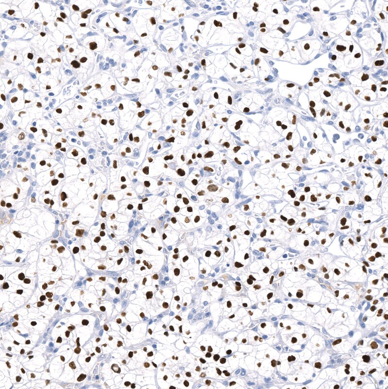 TCF-2/HNF-1 beta Antibody (CL0374) - BSA Free