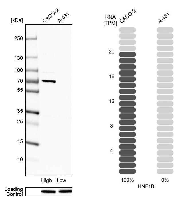 TCF-2/HNF-1 beta Antibody (CL0374) - BSA Free