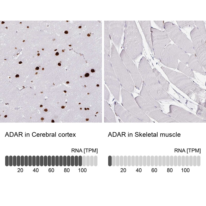 ADAR Antibody (CL0176) - BSA Free