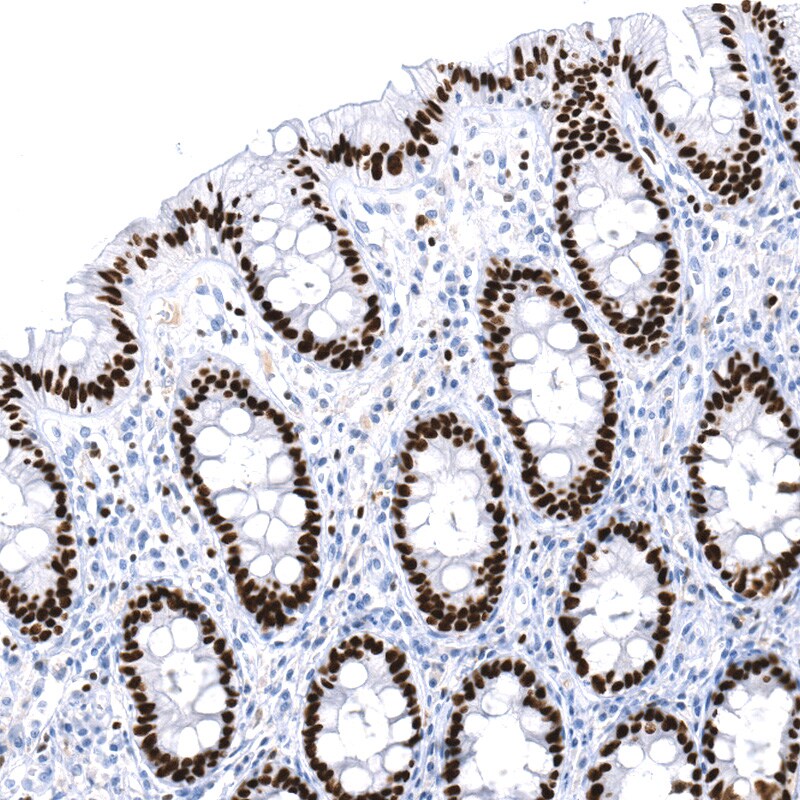 SATB2 Antibody (CL0276) - BSA Free