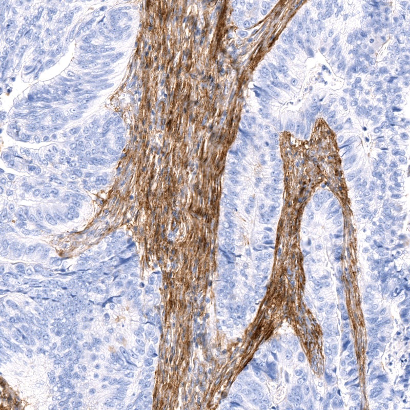 Resource Load Matrix Fibulin 1 Antibody (CL0337) - BSA Free NBP3-57828: Novus Biologicals