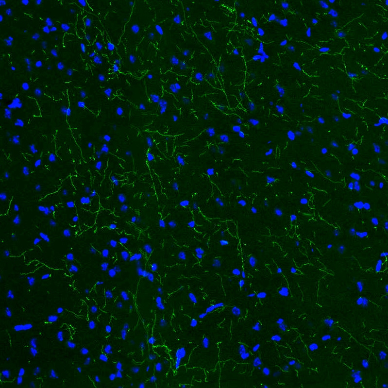 Tryptophan hydroxylase 2 Antibody (CL2990) - BSA Free