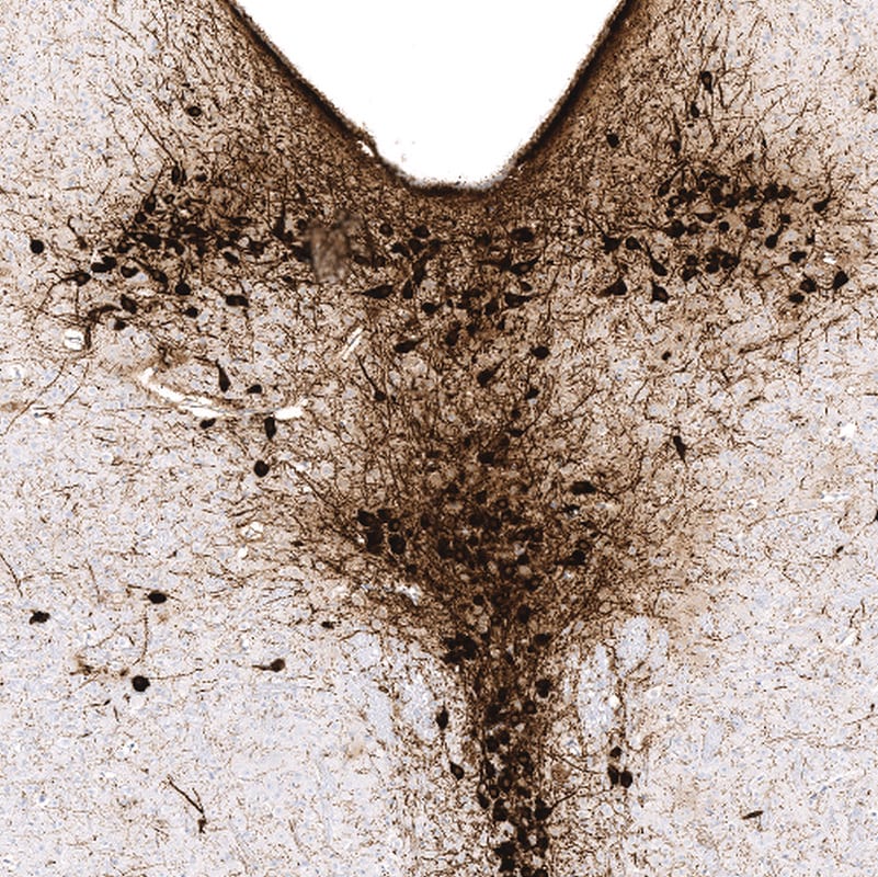Tryptophan hydroxylase 2 Antibody (CL2990) - BSA Free