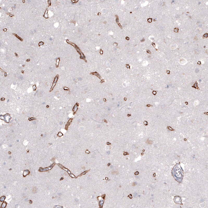 Laminin alpha 2 Antibody (CL3450) - BSA Free