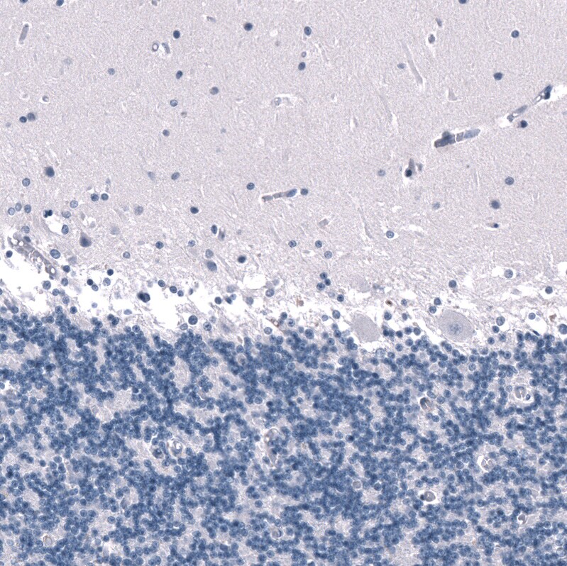 SALL4 Antibody (CL12183) - BSA Free