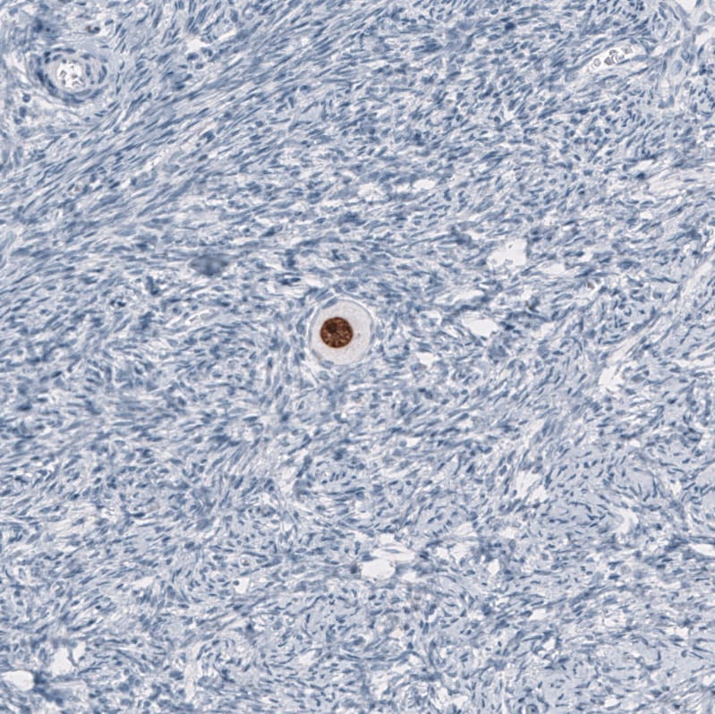 SALL4 Antibody (CL12183) - BSA Free