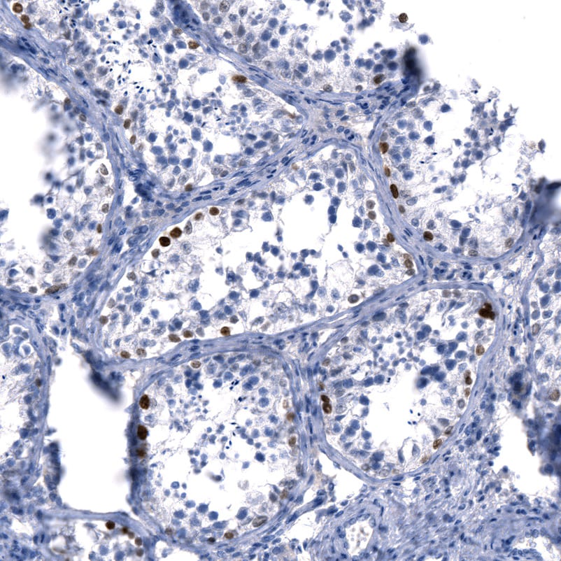 SALL4 Antibody (CL12183) - BSA Free
