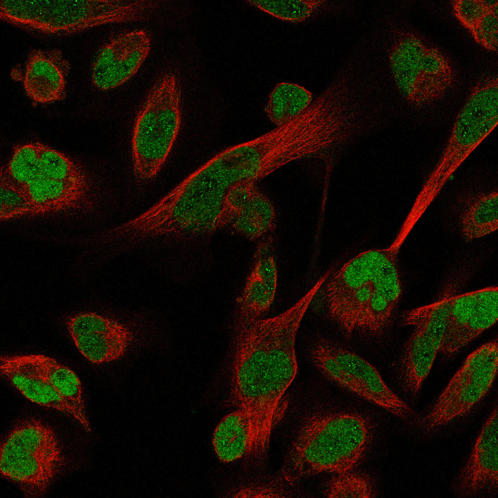 ATF3 Antibody (CL1685) - BSA Free
