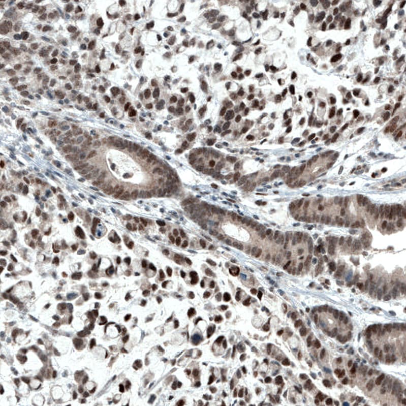 ATF3 Antibody (CL1685) - BSA Free