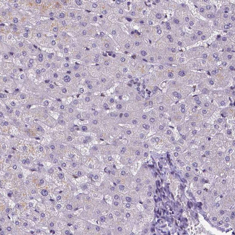 ATRX Antibody (CL0537) - BSA Free