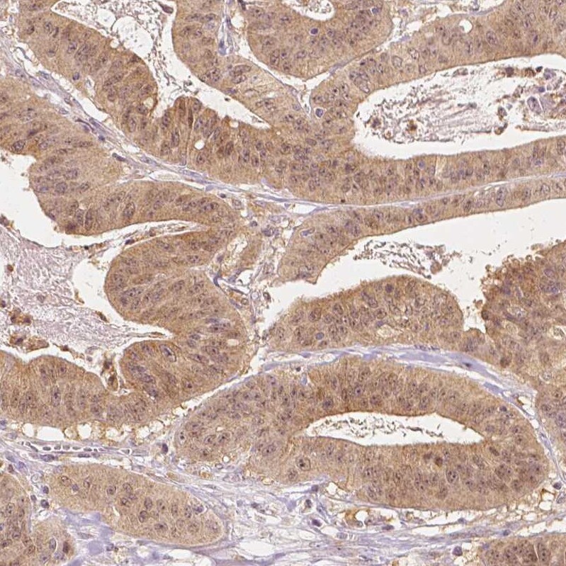 NAPRT1 Antibody (CL0665) - BSA Free