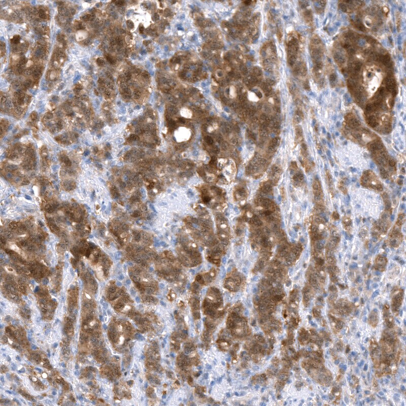 NAPRT1 Antibody (CL0665) - BSA Free