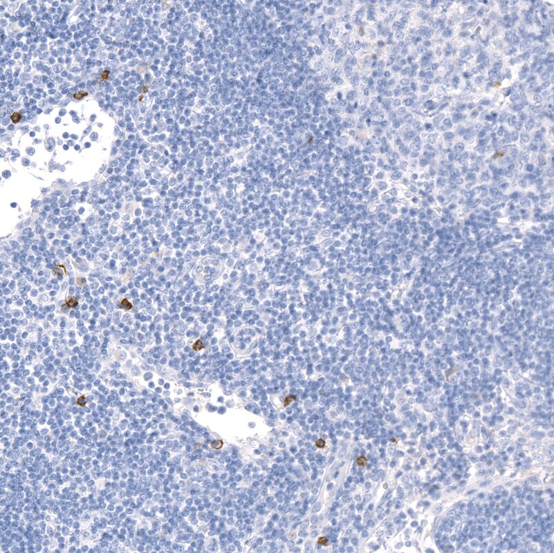 CD117/c-kit Antibody (CL1657) - BSA Free