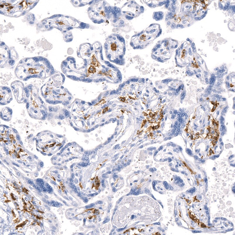 MMR/CD206/Mannose Receptor Antibody (CL0387) - BSA Free