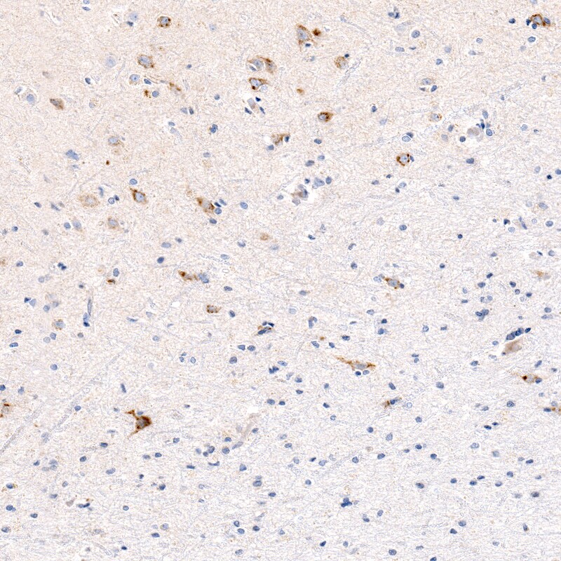 CTGF/CCN2 Antibody (CL5339) - BSA Free