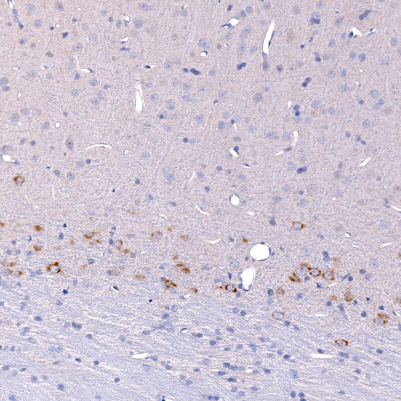 CTGF/CCN2 Antibody (CL5339) - BSA Free