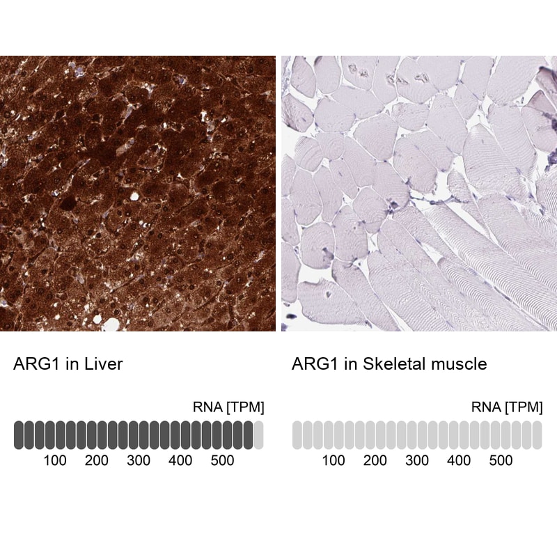 Arginase 1/ARG1/liver Arginase Antibody (CL0186) - BSA Free