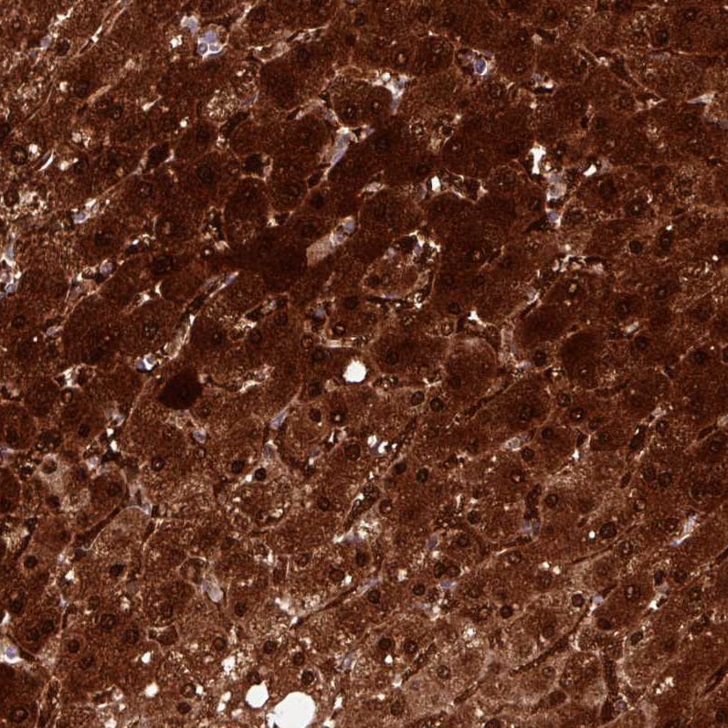 Arginase 1/ARG1/liver Arginase Antibody (CL0186) - BSA Free