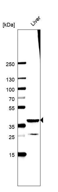 Arginase 1/ARG1/liver Arginase Antibody (CL0186) - BSA Free