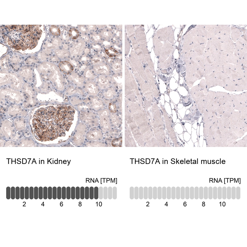 THSD7A Antibody (CL3779) - BSA Free