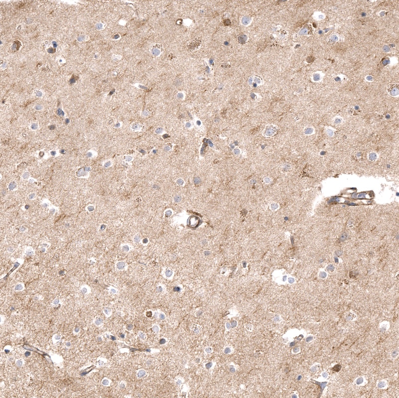 THSD7A Antibody (CL3779) - BSA Free