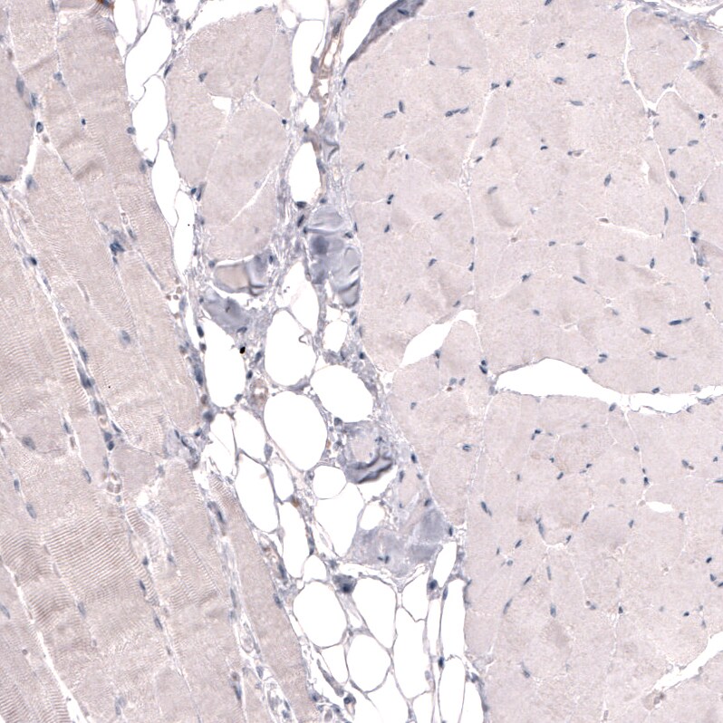 THSD7A Antibody (CL3779) - BSA Free