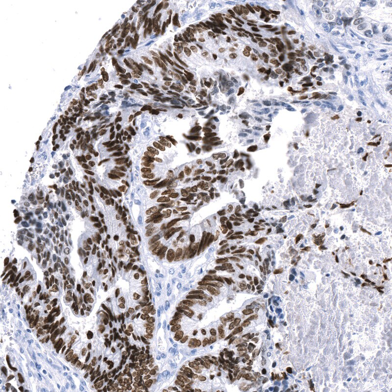 SATB2 Antibody (CL0276) - BSA Free