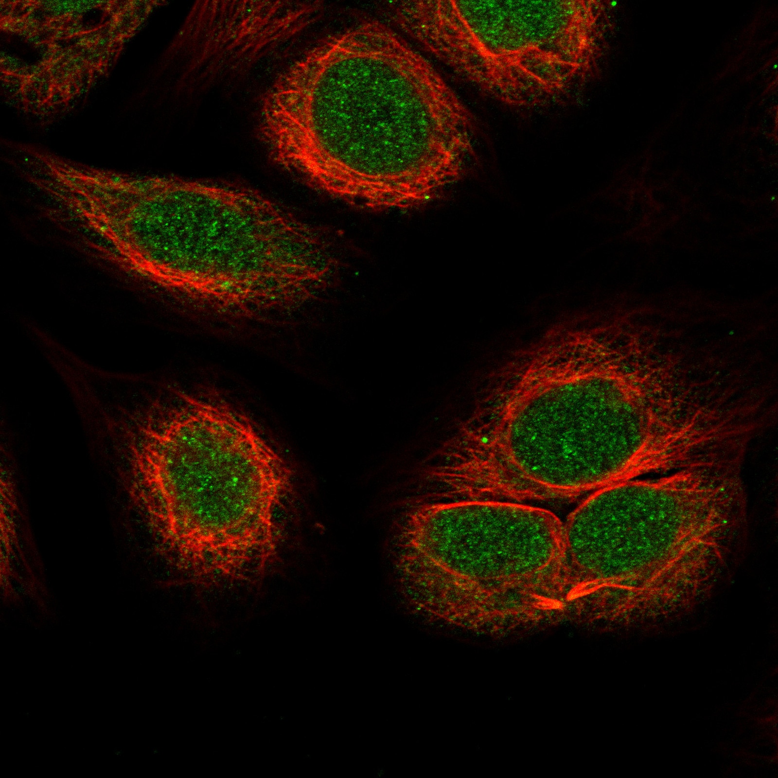 ATRX Antibody (CL0537) - BSA Free