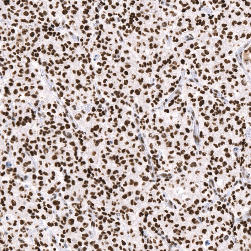 ATRX Antibody (CL0537) - BSA Free