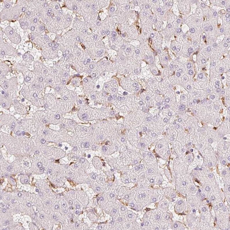 MMR/CD206/Mannose Receptor Antibody (CL0387) - BSA Free