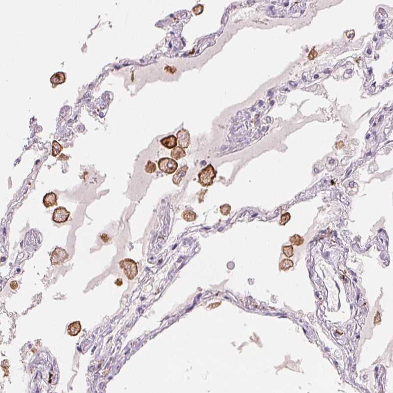 MMR/CD206/Mannose Receptor Antibody (CL0387) - BSA Free