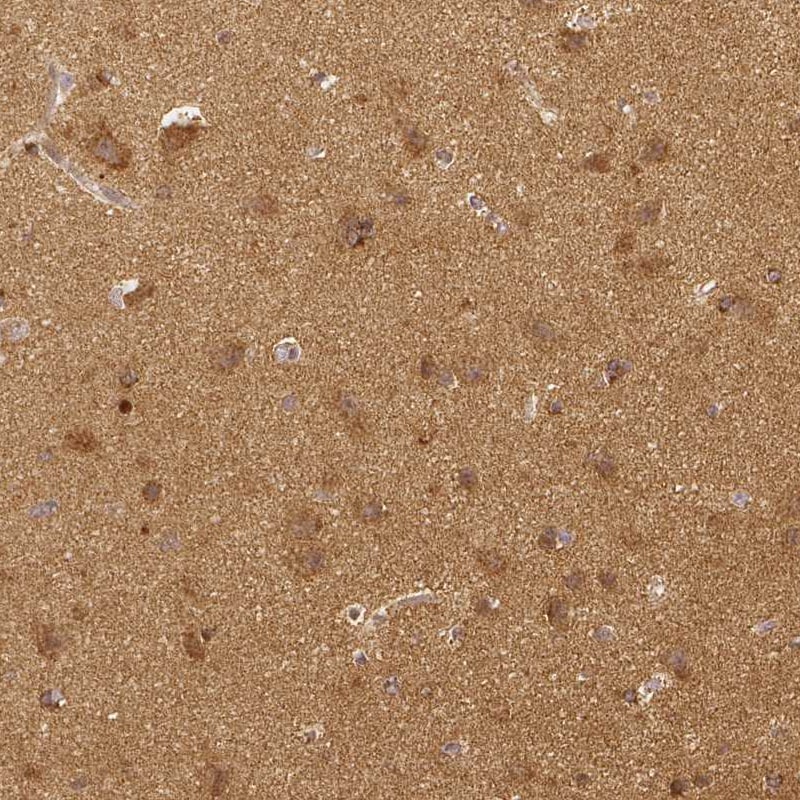 Rhot1 Antibody (CL1083) - BSA Free