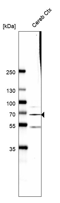 Rhot1 Antibody (CL1083) - BSA Free